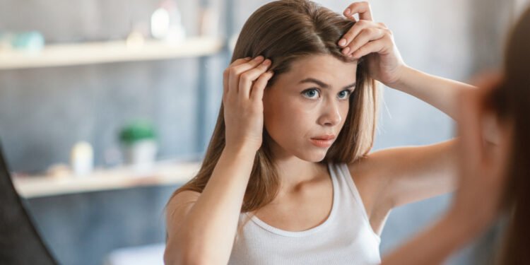 Kaip atskirti utėles nuo pleiskanų