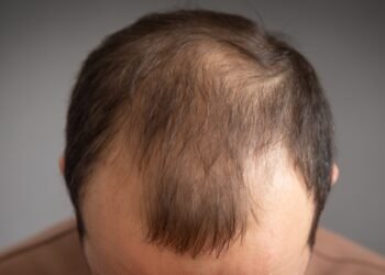 Vyrai, mokslininkų teigimu, plikumas jus daro patrauklesnius