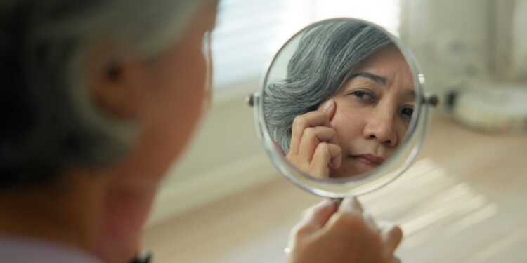Štai ką gali reikšti raudona dėmelė akyje