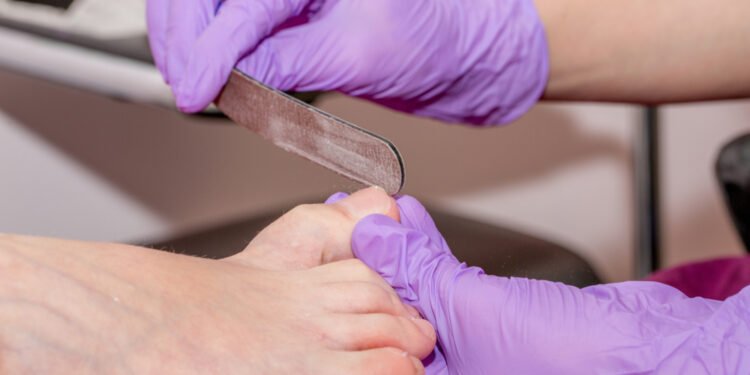 Kaip dildyti nagus, kad jie nebesluoksniuotų ir nelūžinėtų