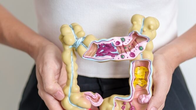 18 metų kentėjau nuo sunkios dirgliosios žarnos sindromo formos, kol vienas gydymas viską pakeitė