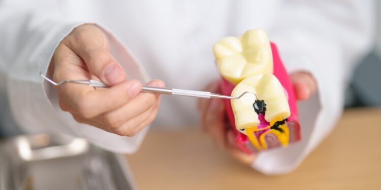 Štai kas nutinka, kai nepaisote dantų ėduonies