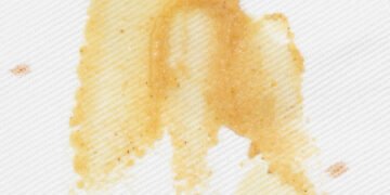 Kaip išvalyti garstyčių dėmes iš drabužių