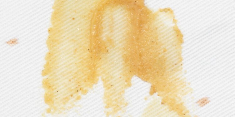 Kaip išvalyti garstyčių dėmes iš drabužių