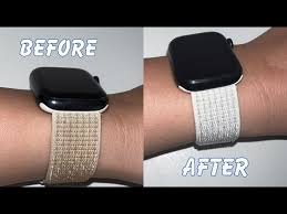 Kaip išvalyti „Apple Watch“ apyrankę, kad atrodytų kaip nauja