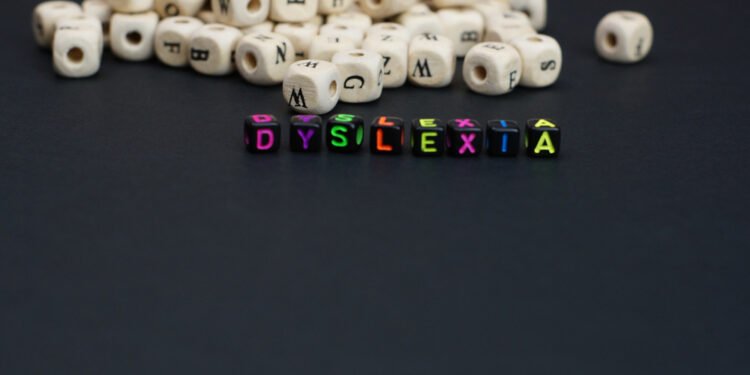 Sudėtingiausias angliškas žodis – vos trys raidės