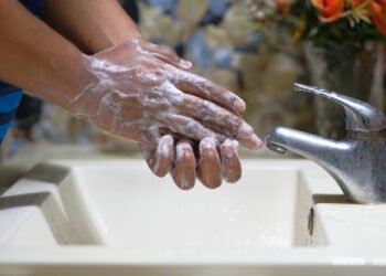 Sprendimai nešvarioms ar nemalonaus kvapo rankoms