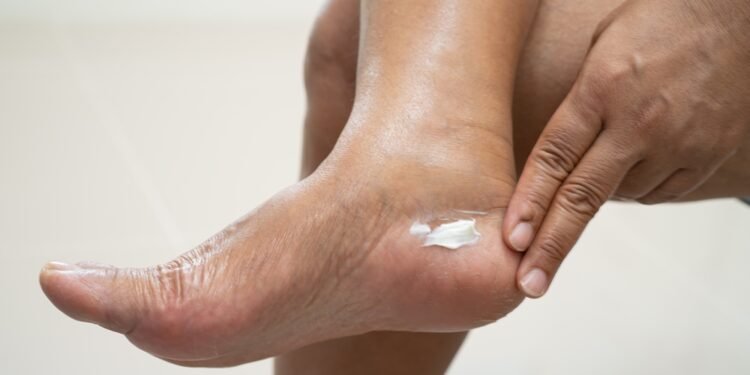 Odos balzamas, greitai sušvelninantis sausą ir suskilinėjusią odelę aplink nagus