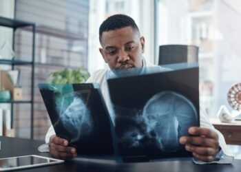 5 žmonės, kuriems smegenų traumos suteikė neįprastų gebėjimų