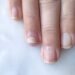 Ką reiškia baltos dėmelės ant jūsų nagų