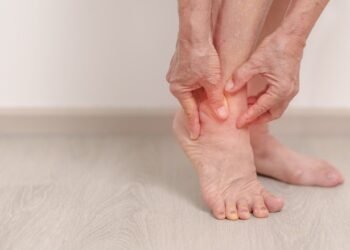 Paaiškėjo, kad mano „patempti čiurnos sąnariai“ iš tikrųjų buvo negydoma podagra