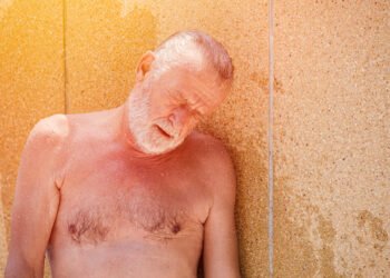 Kasdieniai daiktai, kurie per kaitrą įkaista pavojingai