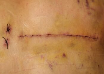 Ši randas liks man visam gyvenimui – štai kodėl jo neslėpsiu